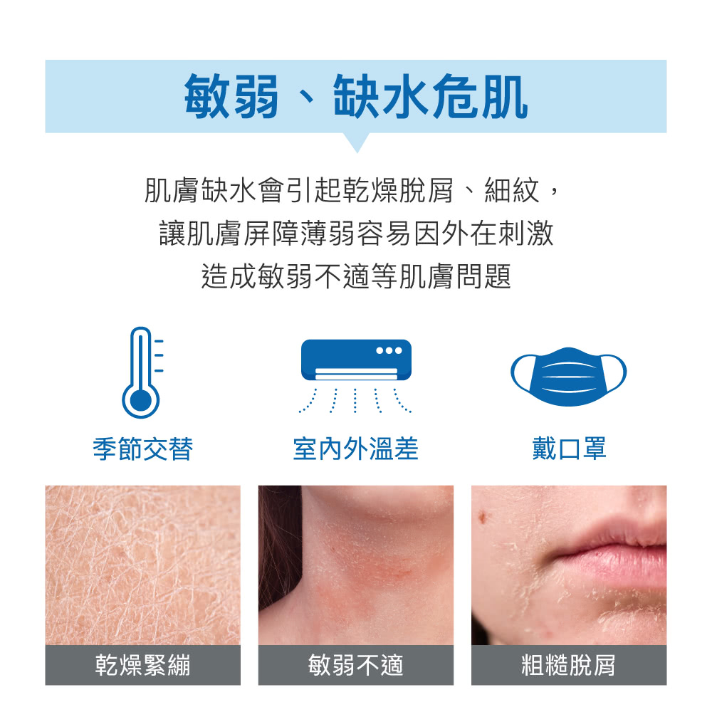 肌肤缺水会引起干燥脱屑、细纹,