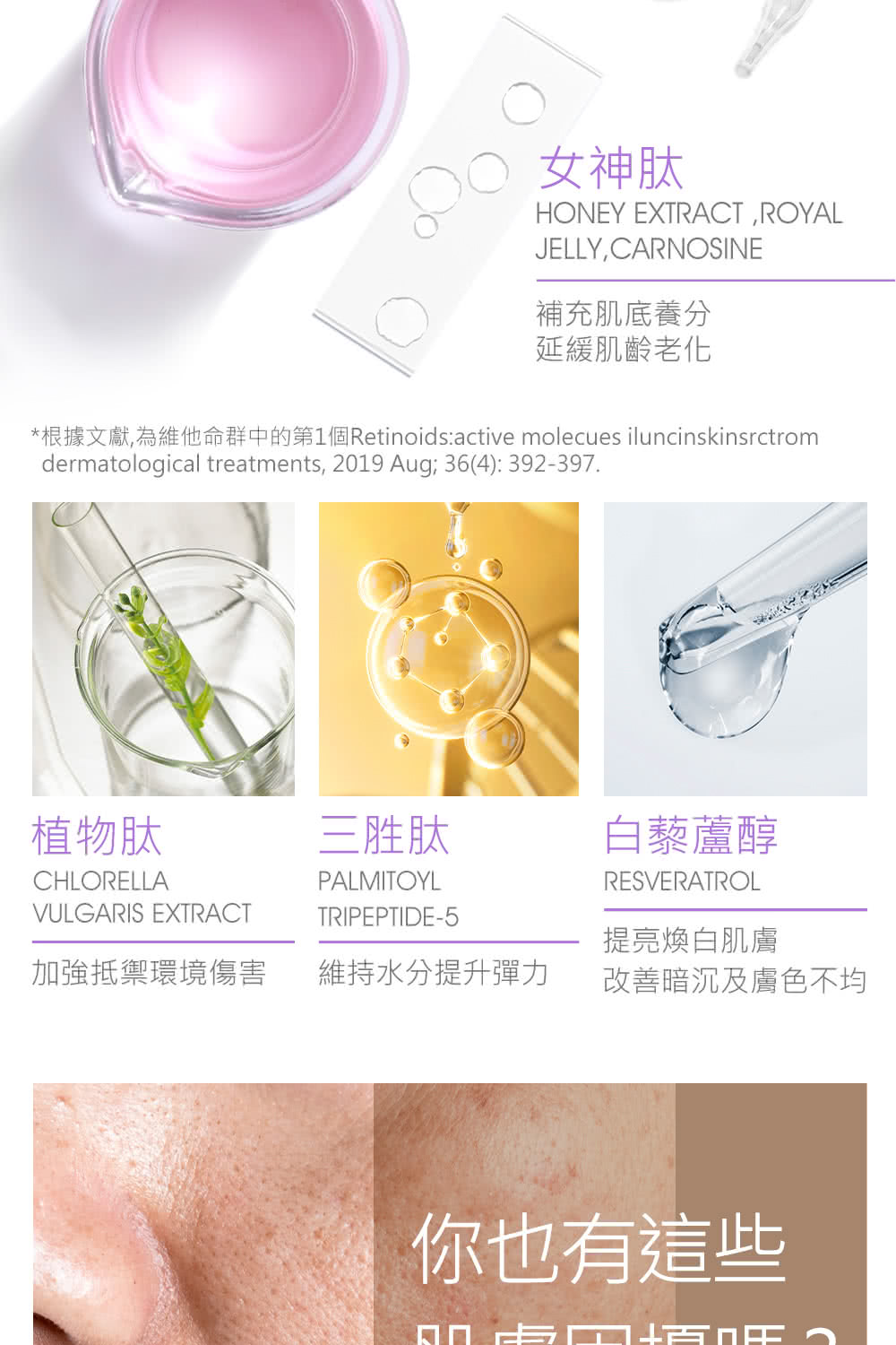 根据文献,为维他命群中的第1个Retinoidsactive molecues iluncinskinsrctrom