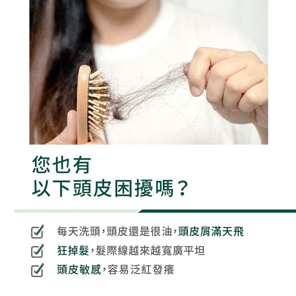 您也有 以下头皮困扰吗 每天洗头,头皮还是很油,头皮屑满天飞 M 狂掉发,发际线越来越宽广平坦 头皮敏感,容易泛红发痒 