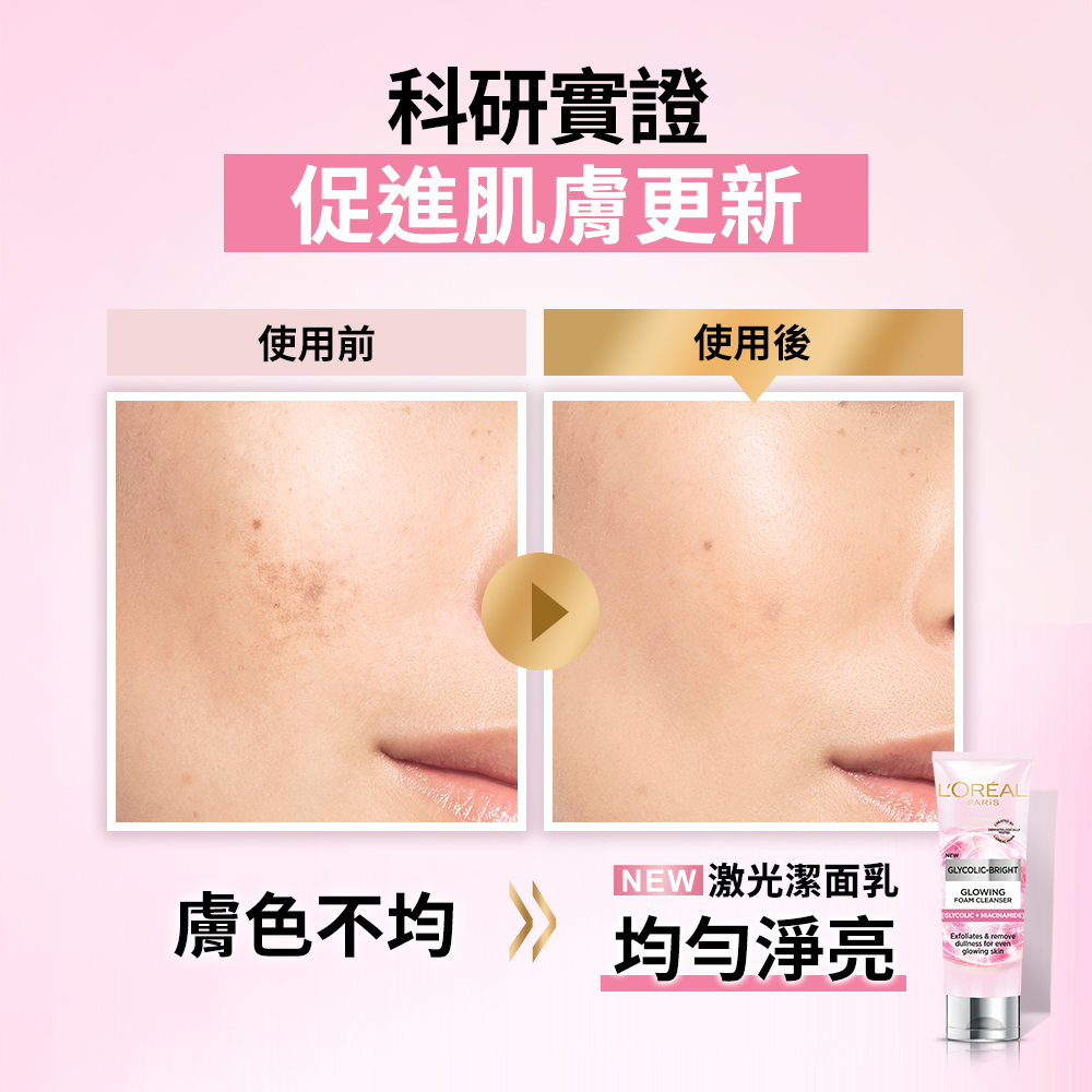 肤色不均 均匀净亮