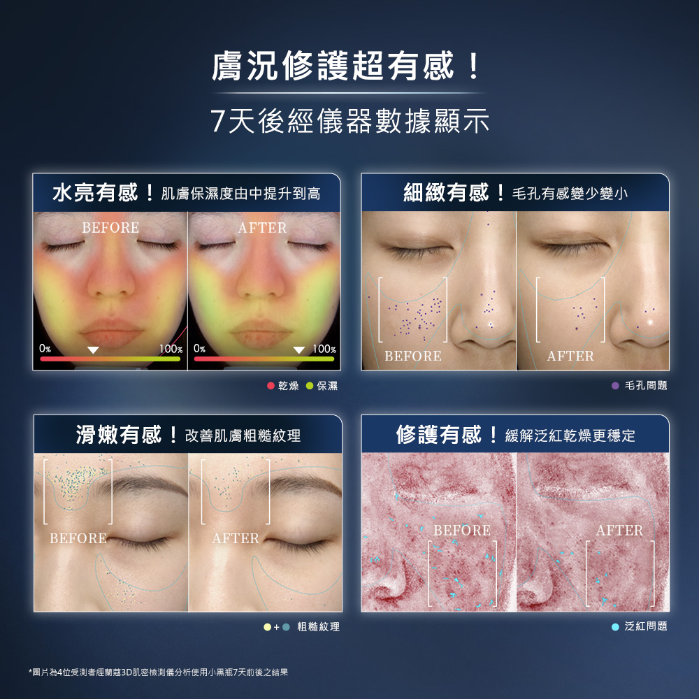 图片为4位受测者经兰蔻3D肌密检测仪分析使用小黑瓶7天前后之结果