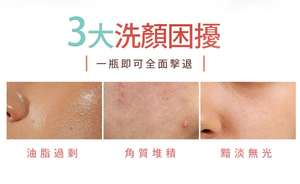 3大洗颜困扰 一瓶即可全面击退 油脂过剩 角质堆积 黯淡无光 