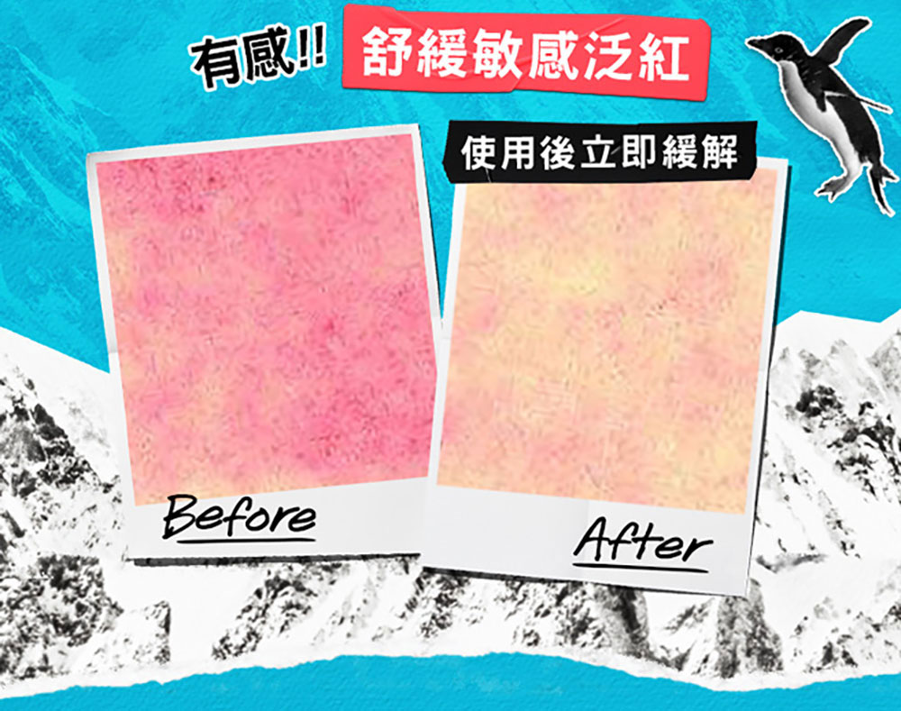 有感 舒缓敏感泛红 使用后立即缓解 