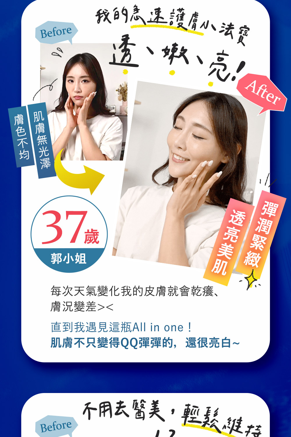 直到我遇见这瓶All in one