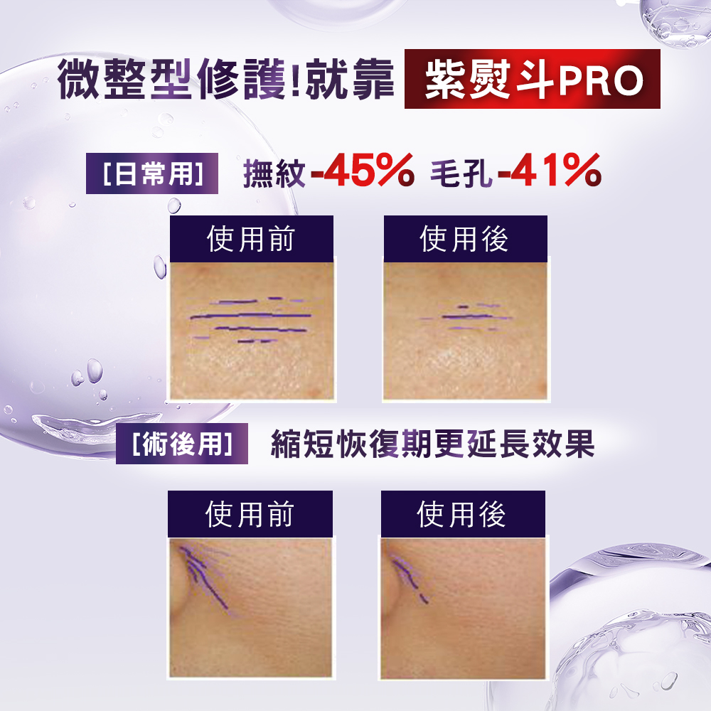 日常用 抚纹45% 毛孔41%