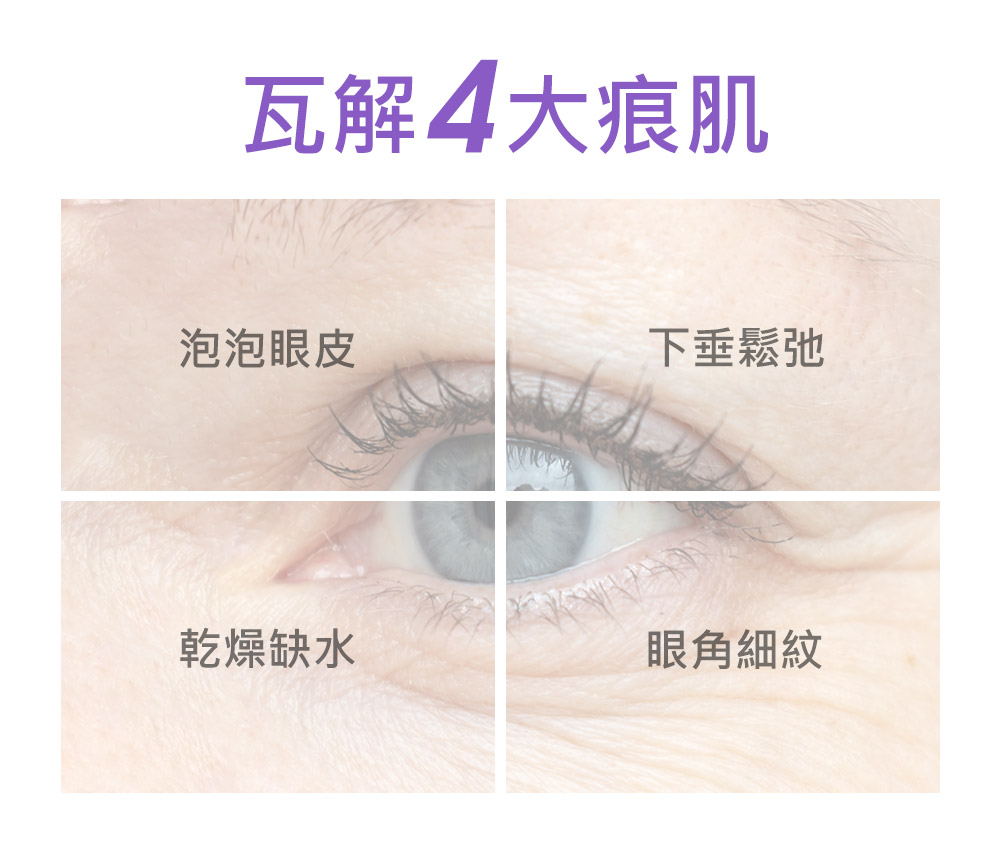 瓦解4大痕肌 泡泡眼皮 干燥缺水 下垂松弛 眼角细纹 