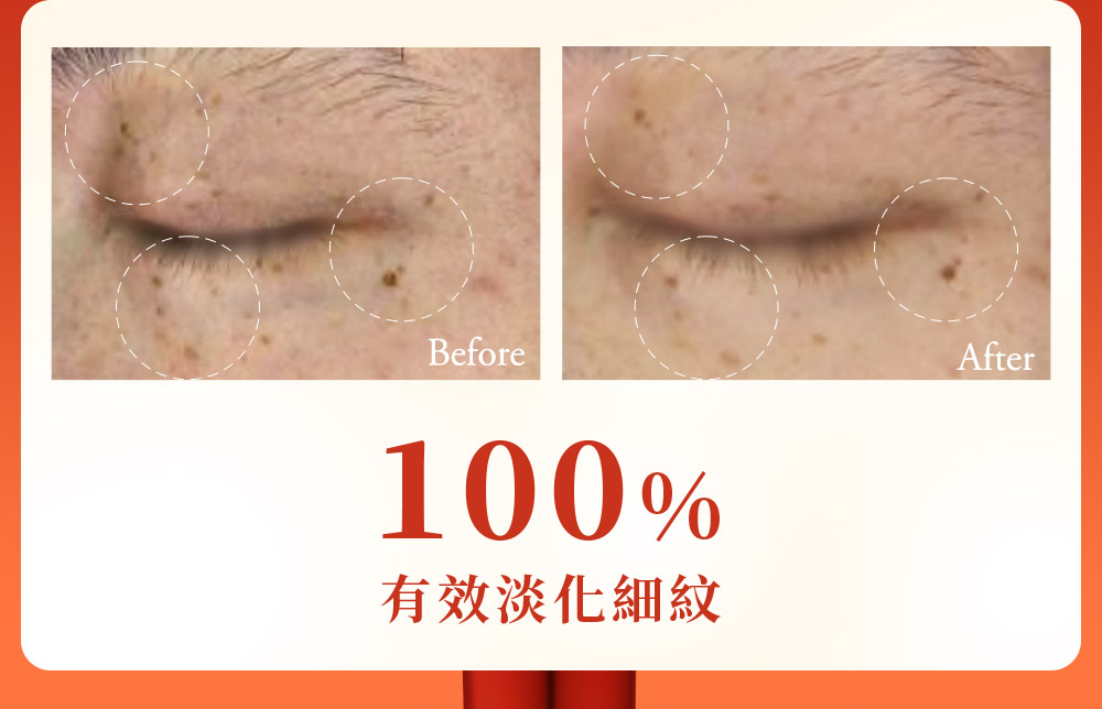 有效淡化细纹 