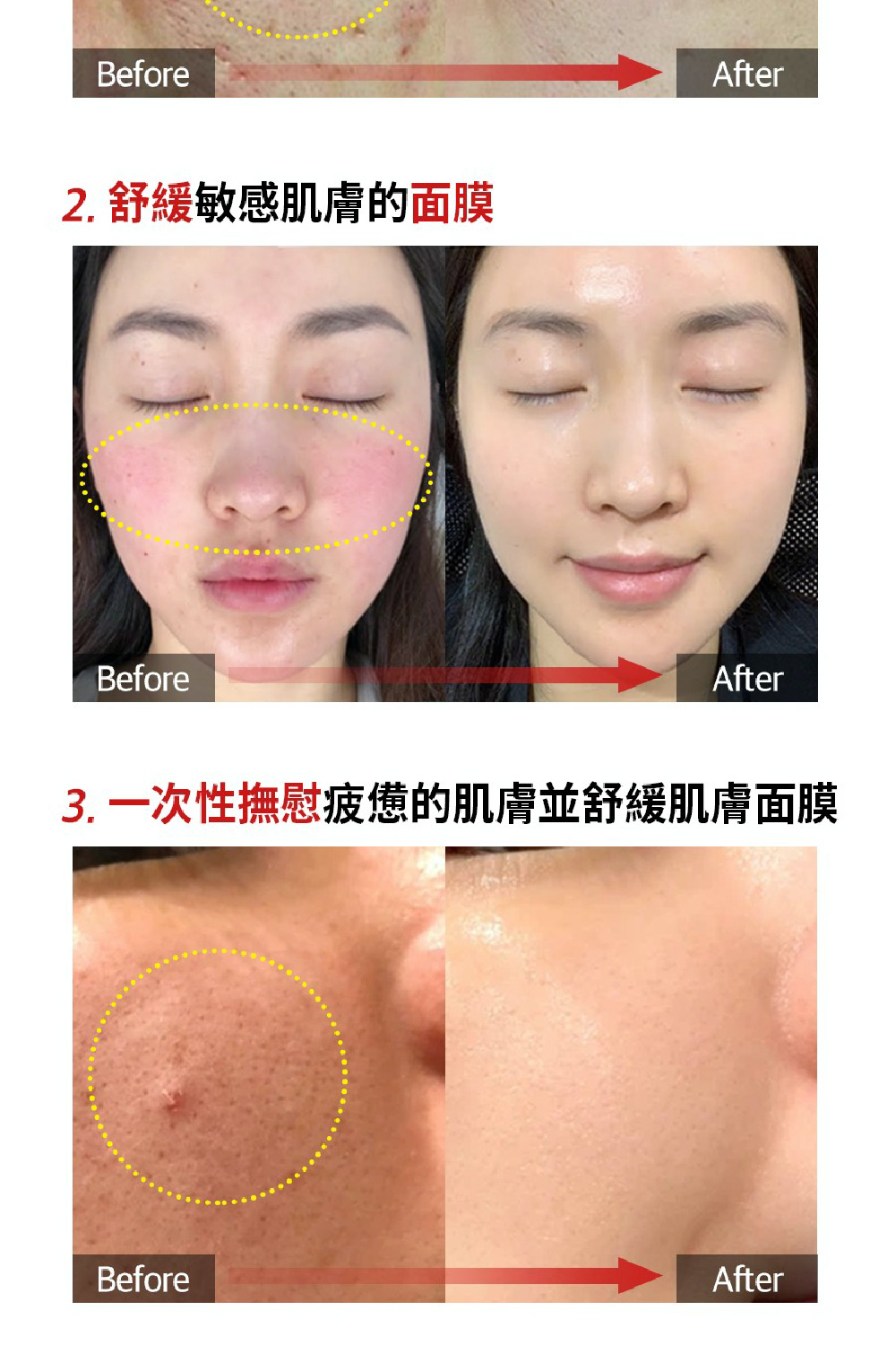 2. 舒缓敏感肌肤的面膜 3. 一次性抚慰疲惫的肌肤并舒缓肌肤面膜 